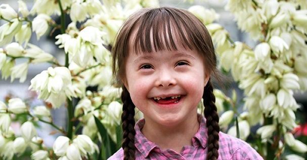 Ilustrasi Anak Tunagrahita | Foto : Unsplash